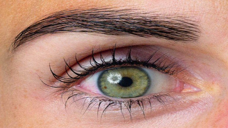 AUGEN AUF